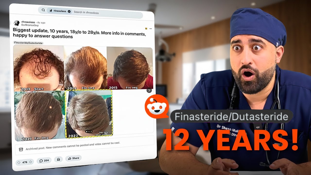 What Happens After 12 Years on Finasteride? (Doctor Reviews the Evidence)