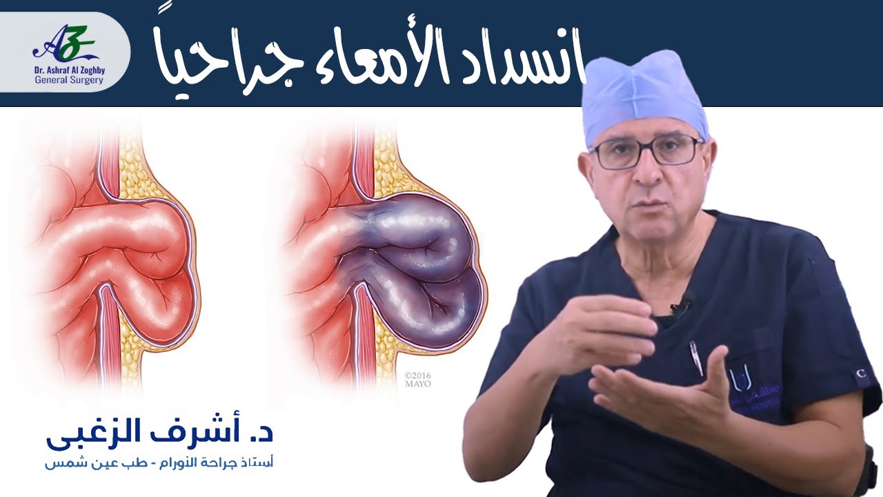 علاج انسداد الأمعاء جراحياً - أ.د/ اشرف الزغبي