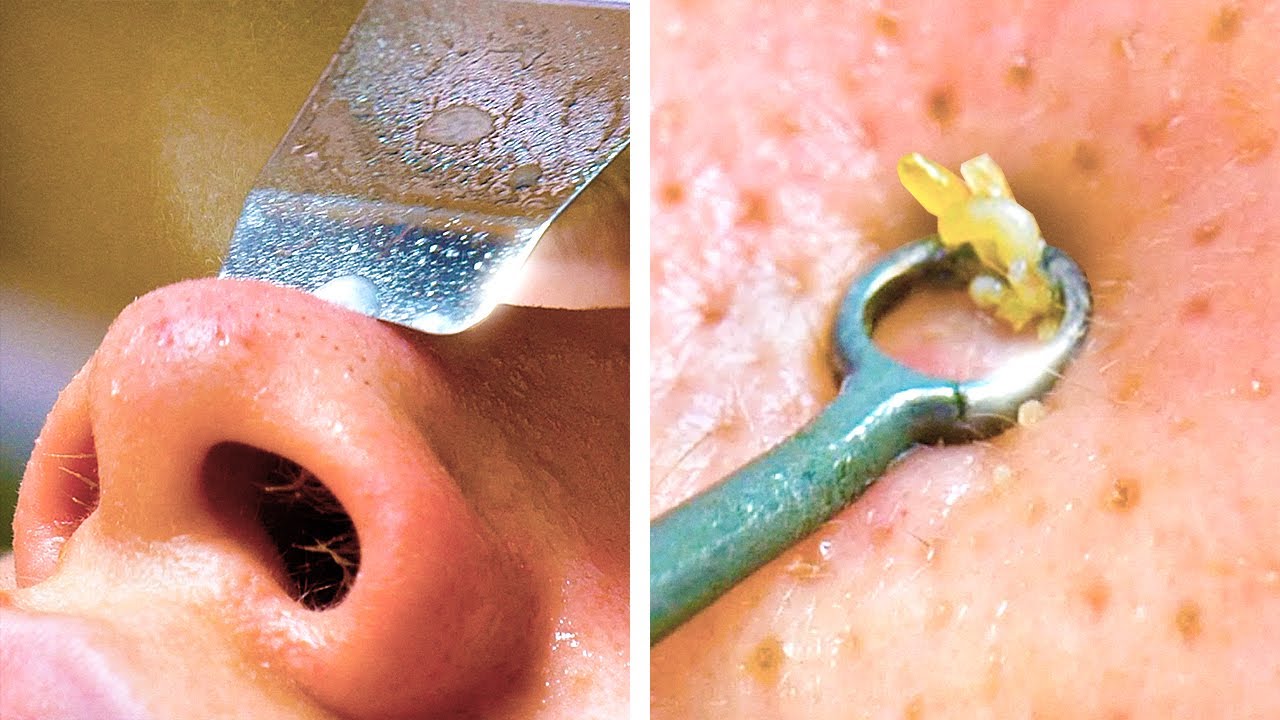 عناية منزلية مثالية للبشرة || إجراءات ونتائج