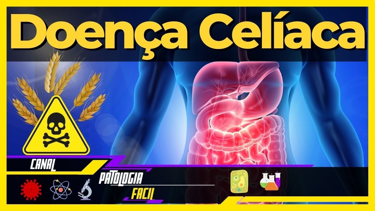 O que &eacute; Doen&ccedil;a Cel&iacute;aca? [Sintomas, Fisiopatologia, Tratamento e Diagn&oacute;stico]