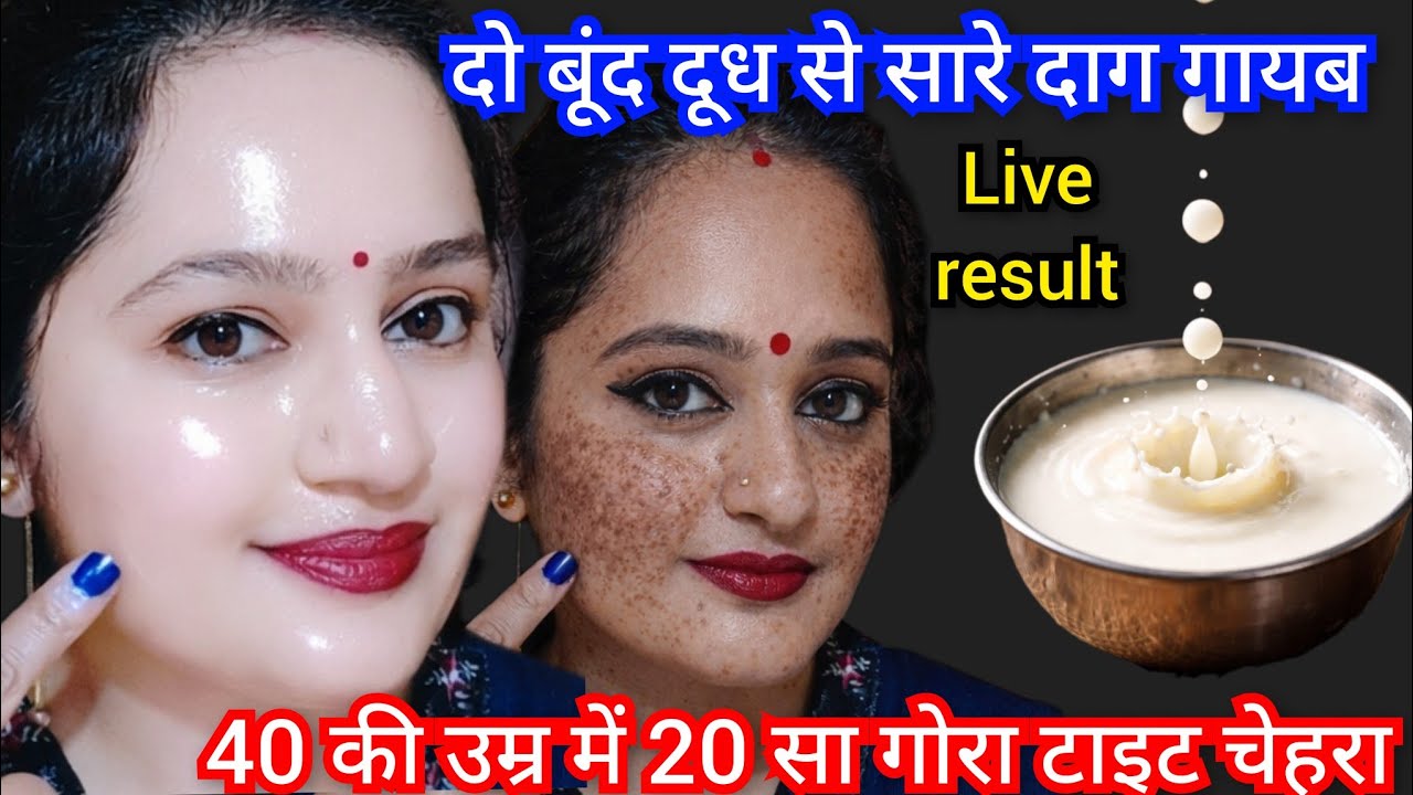 40 साल की ननंद 20 की दिखने लगी🙈दो बूंद दूध से से सारी झाइयां झुर्रिया गायब🙈Wrinkle free Tight skin
