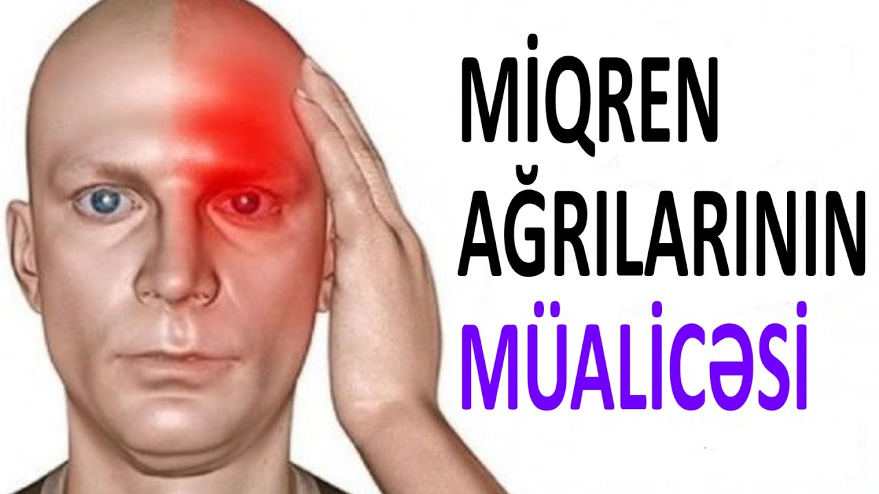 Miqren ağrısı - Necə müalicə edilir? (Həkimsən verilişi)