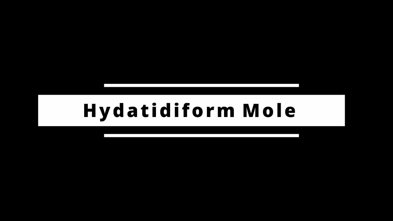 Hydatidiform Mole