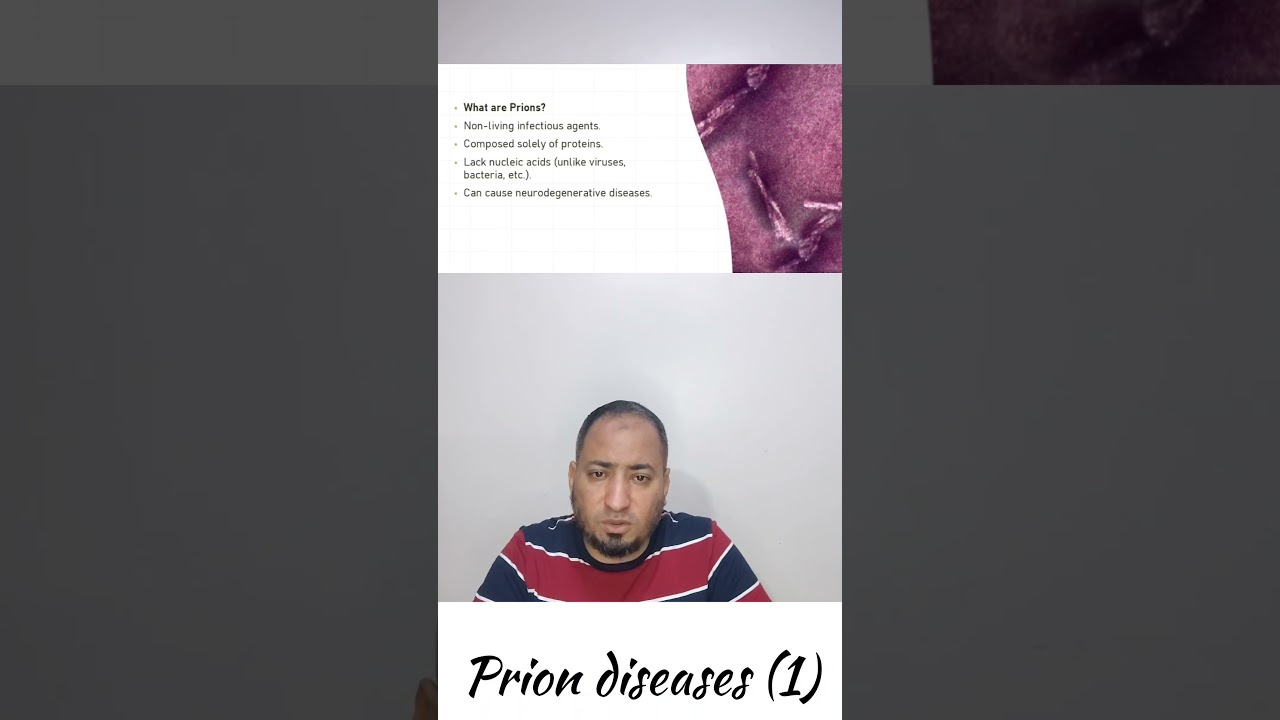 Prion diseases (1)