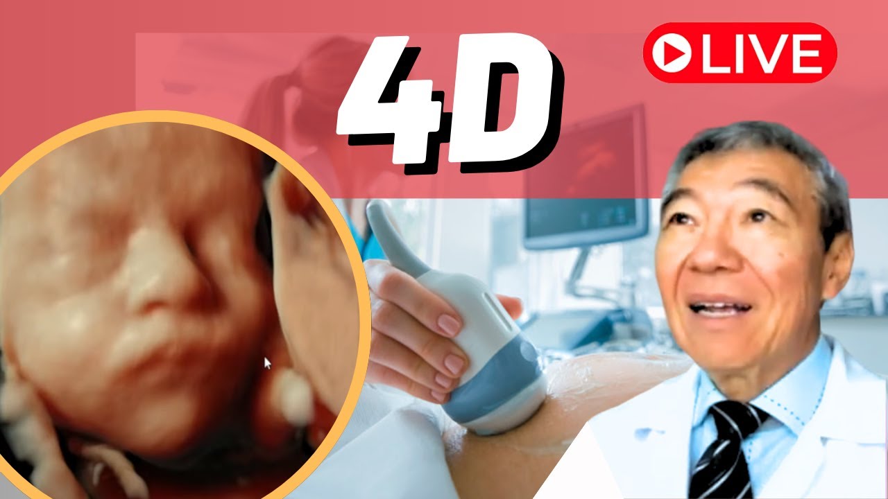 AO VIVO - 4D DE 30 SEMANAS
