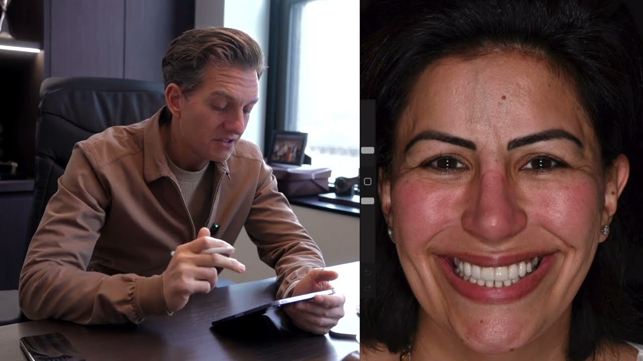 She went to another doctor and came back - VENEERS REDO