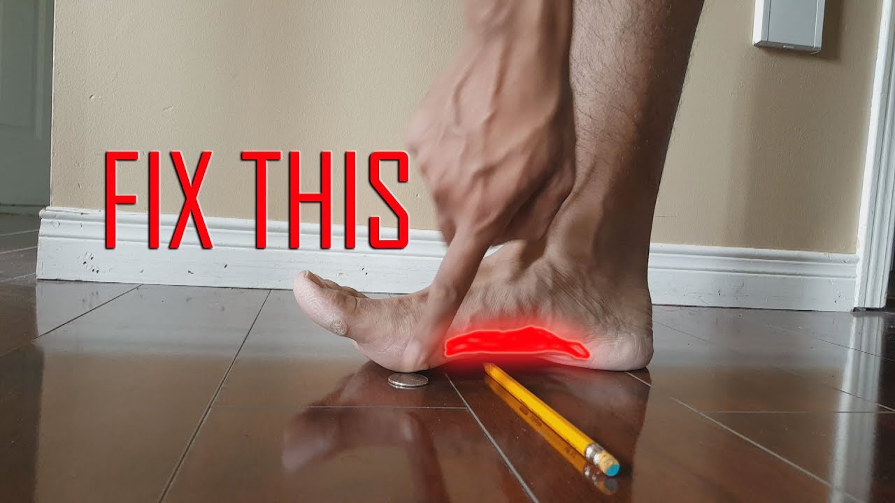 ARE ORTHOTICS THE SOLUTION? HOW TO FIX FLAT FEET