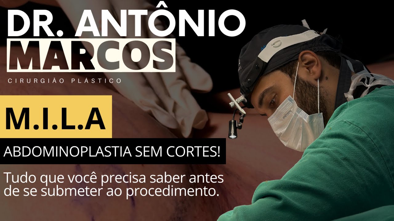 MILA - ABDOMINOPLASTIA SEM CORTES: TUDO QUE VOCÊ PRECISA SABER.