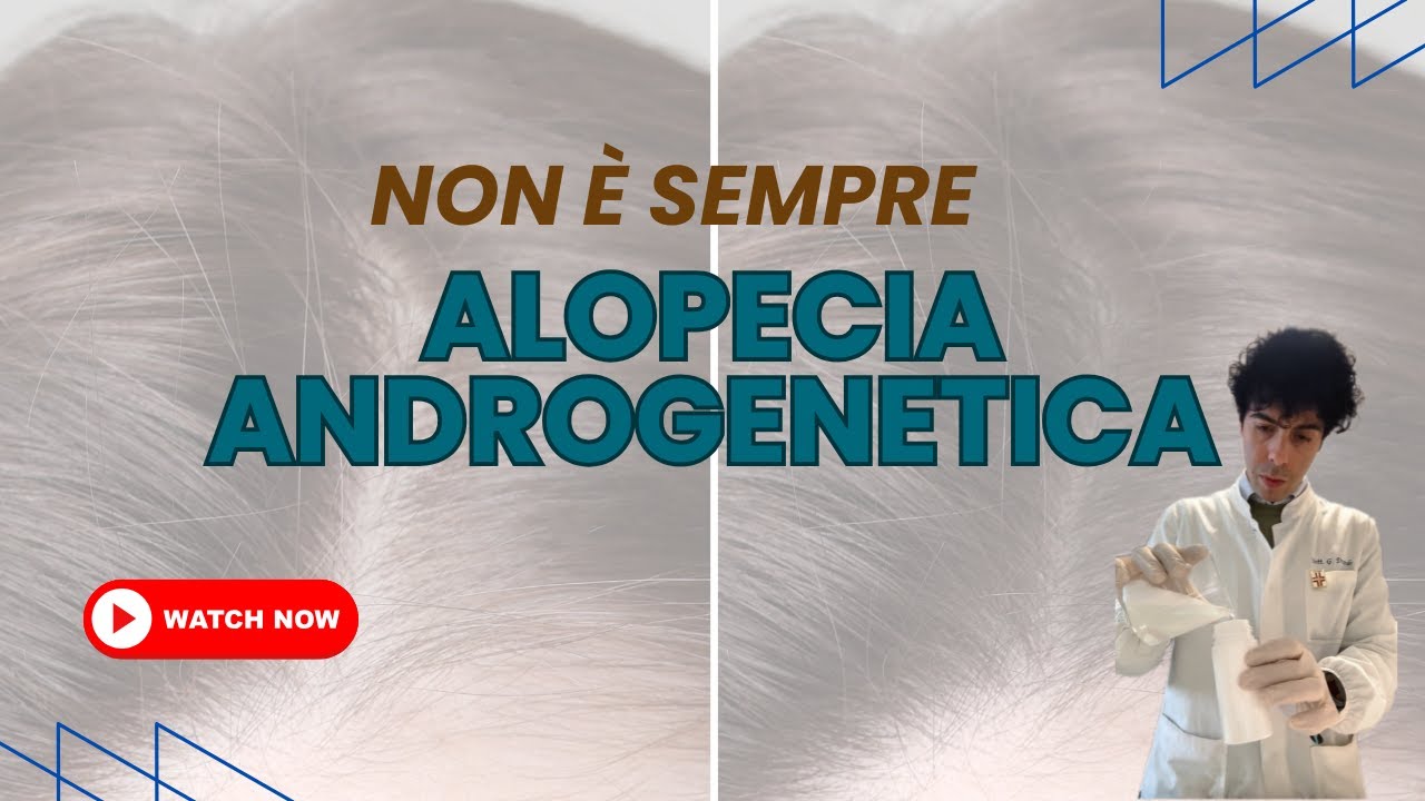 Quando il diradamento NON è alopecia androgenetica
