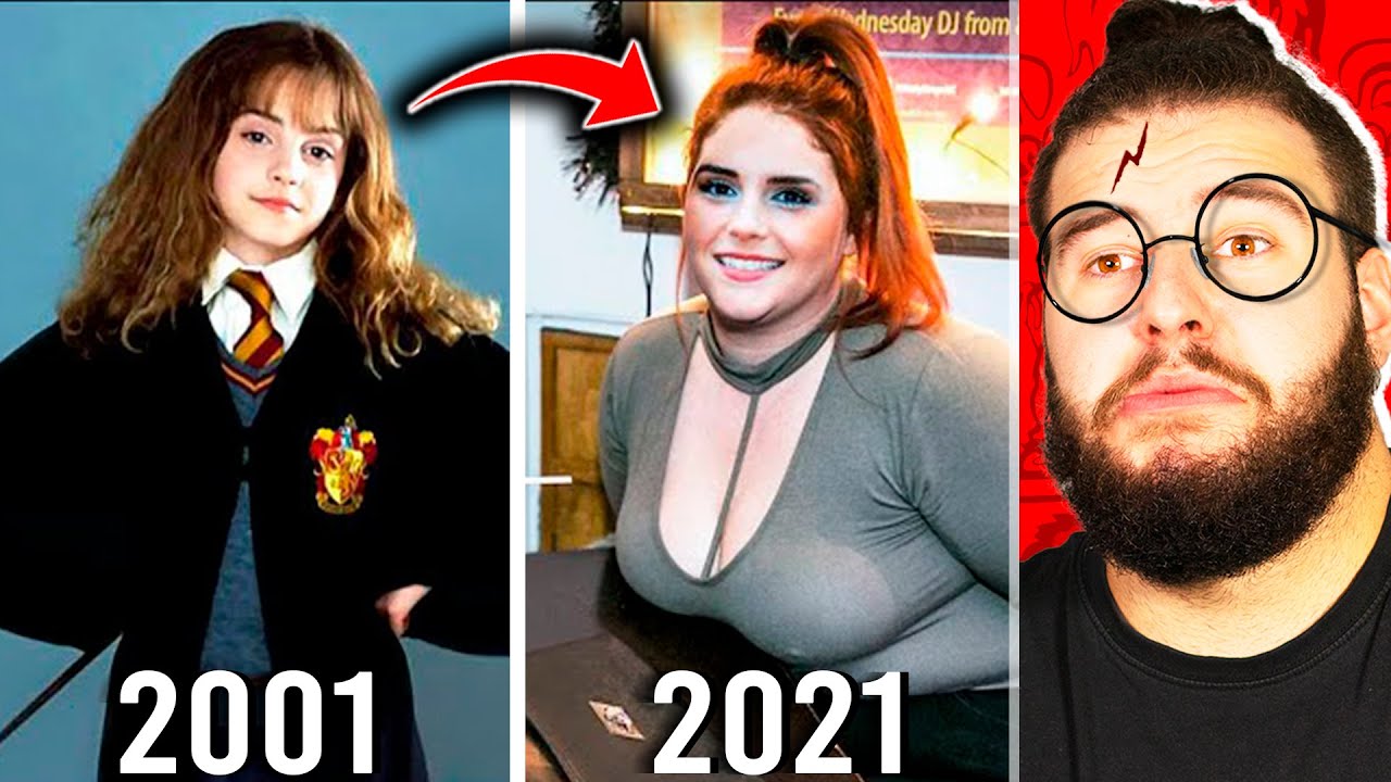 Harry Potter Antes y Después | Cambios Físicos de Famosos 2021