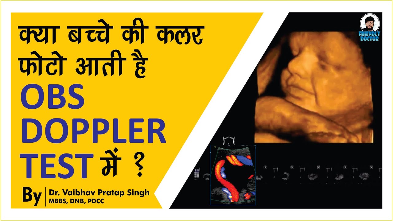 OBS Doppler Ultrasound || What is It and Why It is Important ?