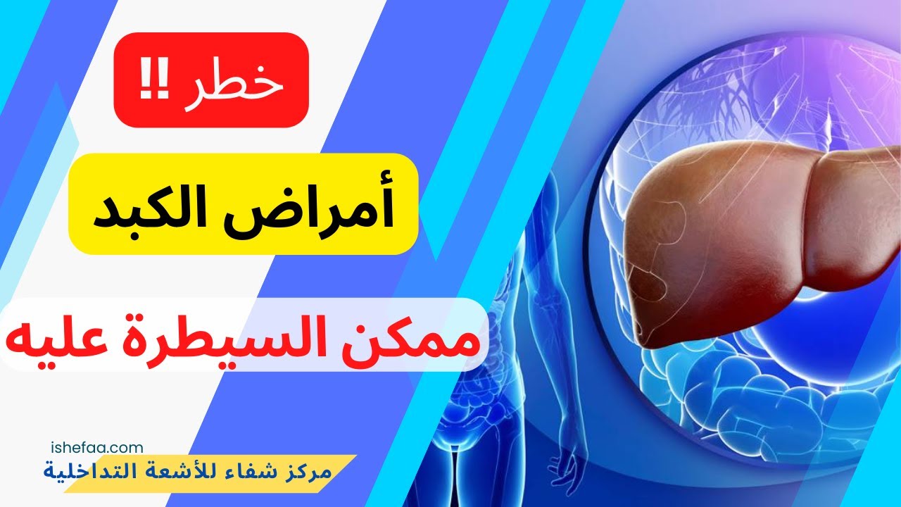 امراض الكبد خطر يمكن السيطرة عليه و ما هي الأعراض و الأسباب و العلاج؟