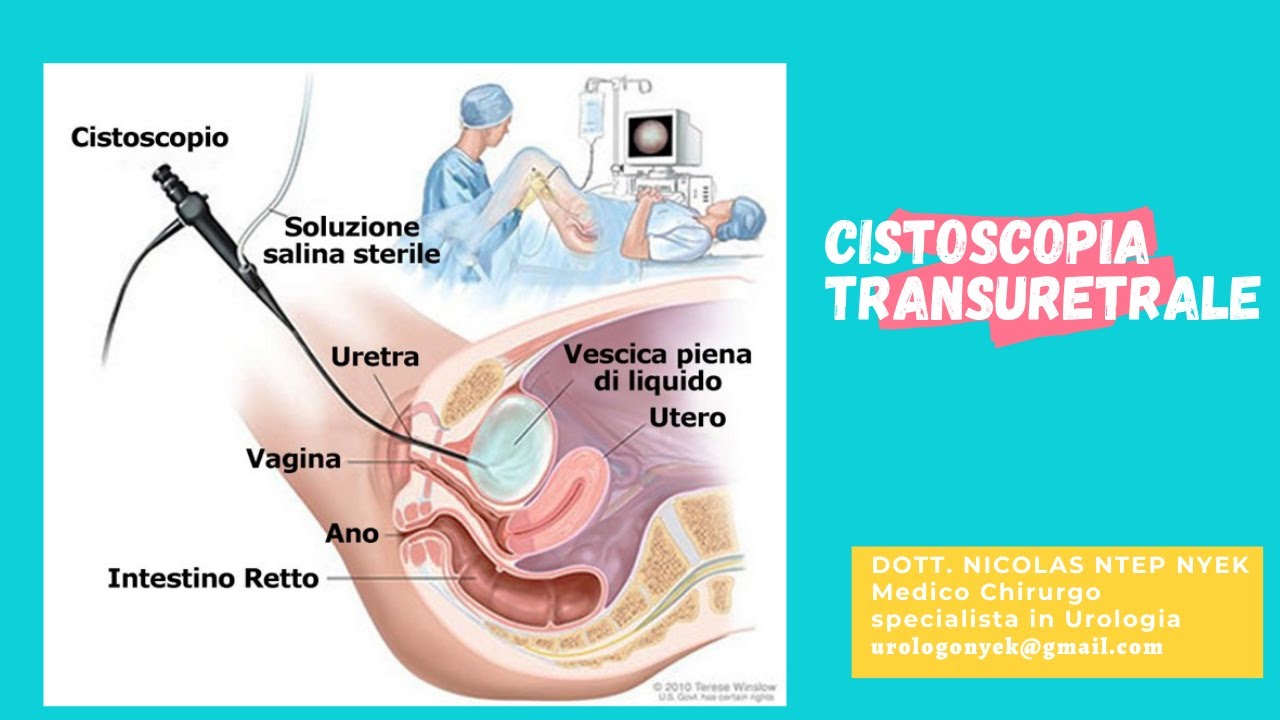 CISTOSCOPIA TRANSURETRALE