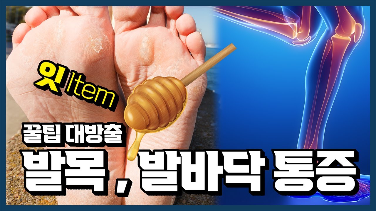 [시술의 신]의사가 말하는 깔창 추천, 깔창 하나 깔았을 뿐인데 통증이 줄어든다고??