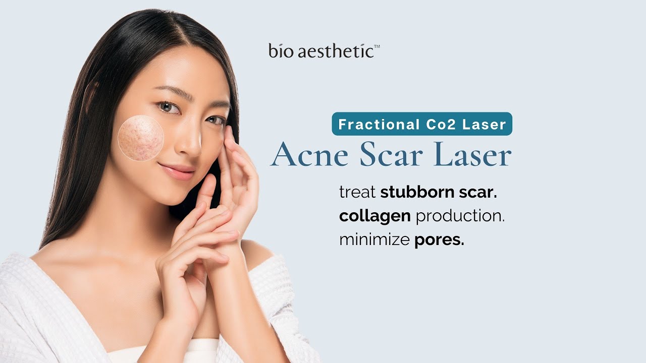 Fractional CO2 Laser: Acne Scar Removal Singapore | Bio Aesthetic