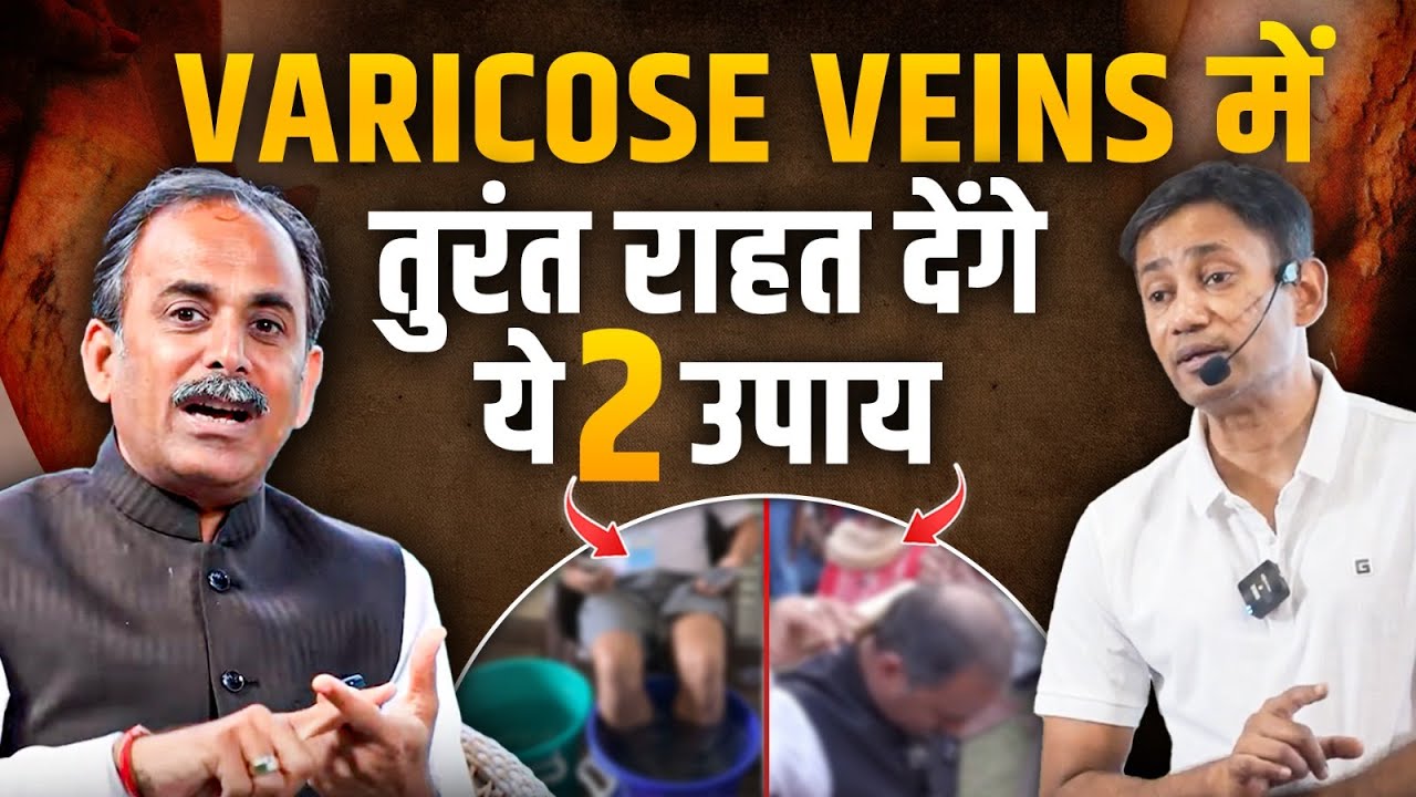 Varicose Veins & Cervical Pain का घरेलू इलाज | Hot - Cold Water Therapy Benefits | Dr. BRC