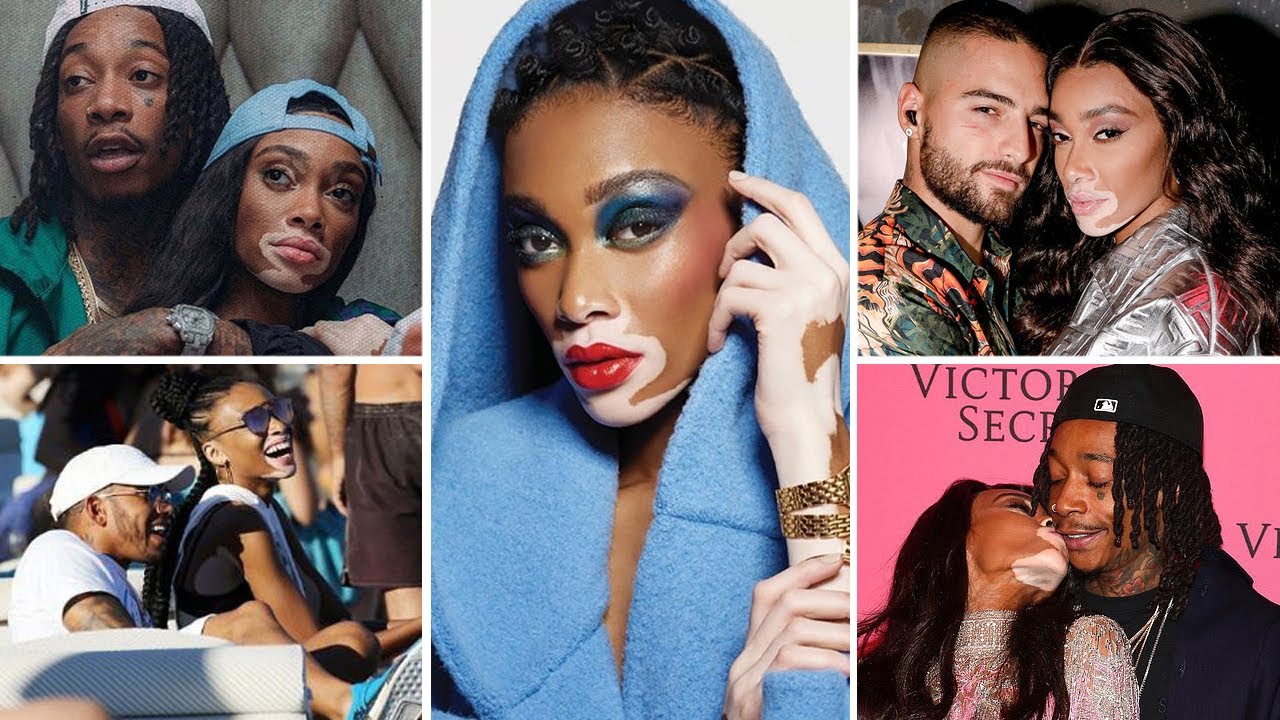 Guys Winnie Harlow Has Dated!