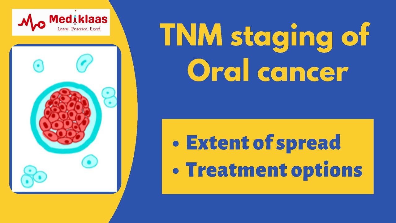 TNM staging of oral cancer l Oral surgery l Mediklaas