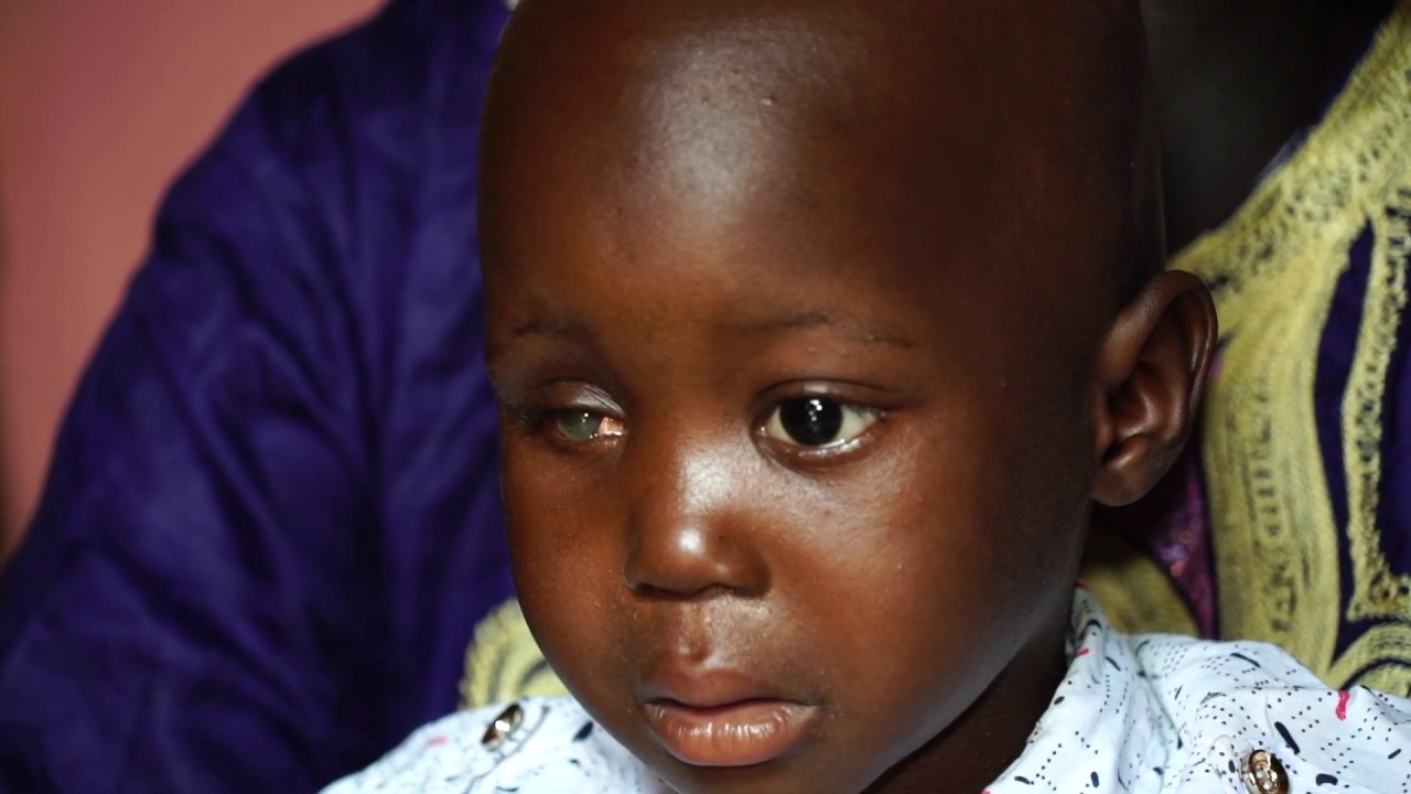 Des enfants victimes d'une tumeur des yeux 👁️  *** BBC Afrique