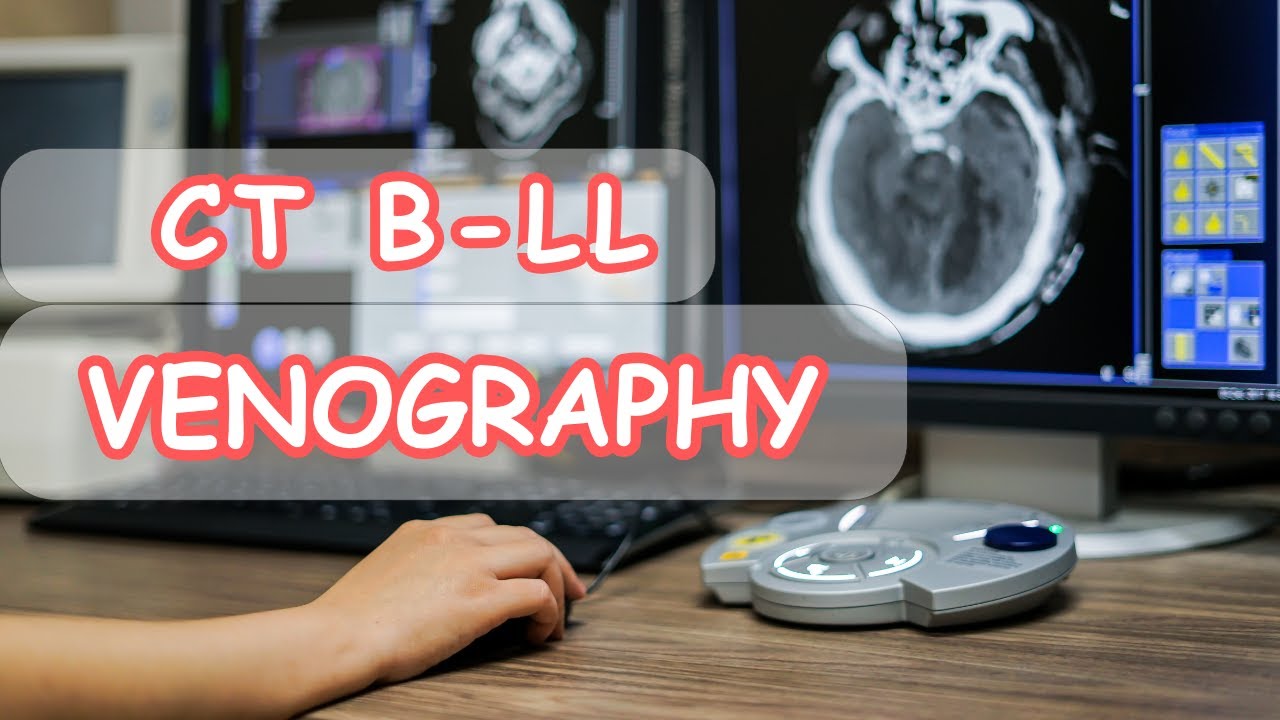 Ct venography both lower limbsالتصوير المقطعى على أوردة الطرفين السفليين