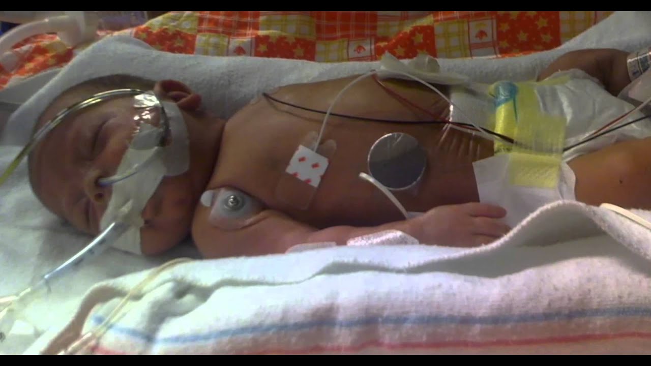 Joseph Romero - CMN Hershey - Penn State Health Children's Hospital