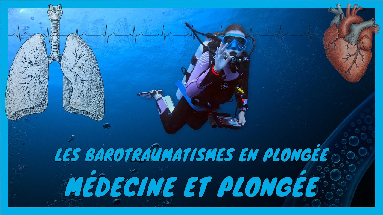 [Médecine et plongée] Les barotraumatismes en plongée