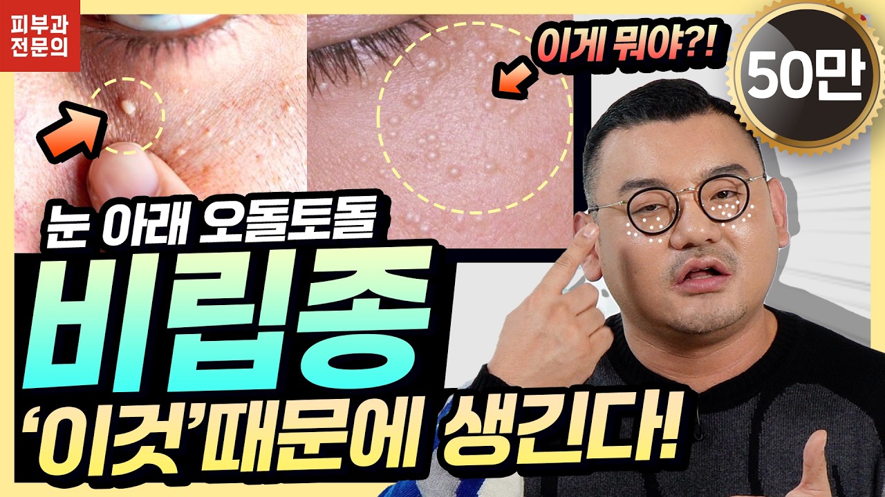 눈밑에 비립종 왜 생길까? 피부과의사가 알려주는 비립종 똑! 없애는 예방법 4가지 (깨끗한 눈가만들기)