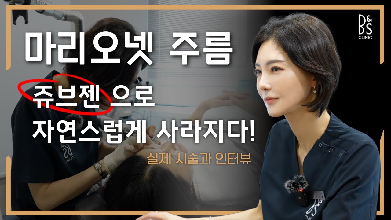 ✨ 마리오넷 주름, 쥬브젠으로 자연스럽게 개선하기 ✨