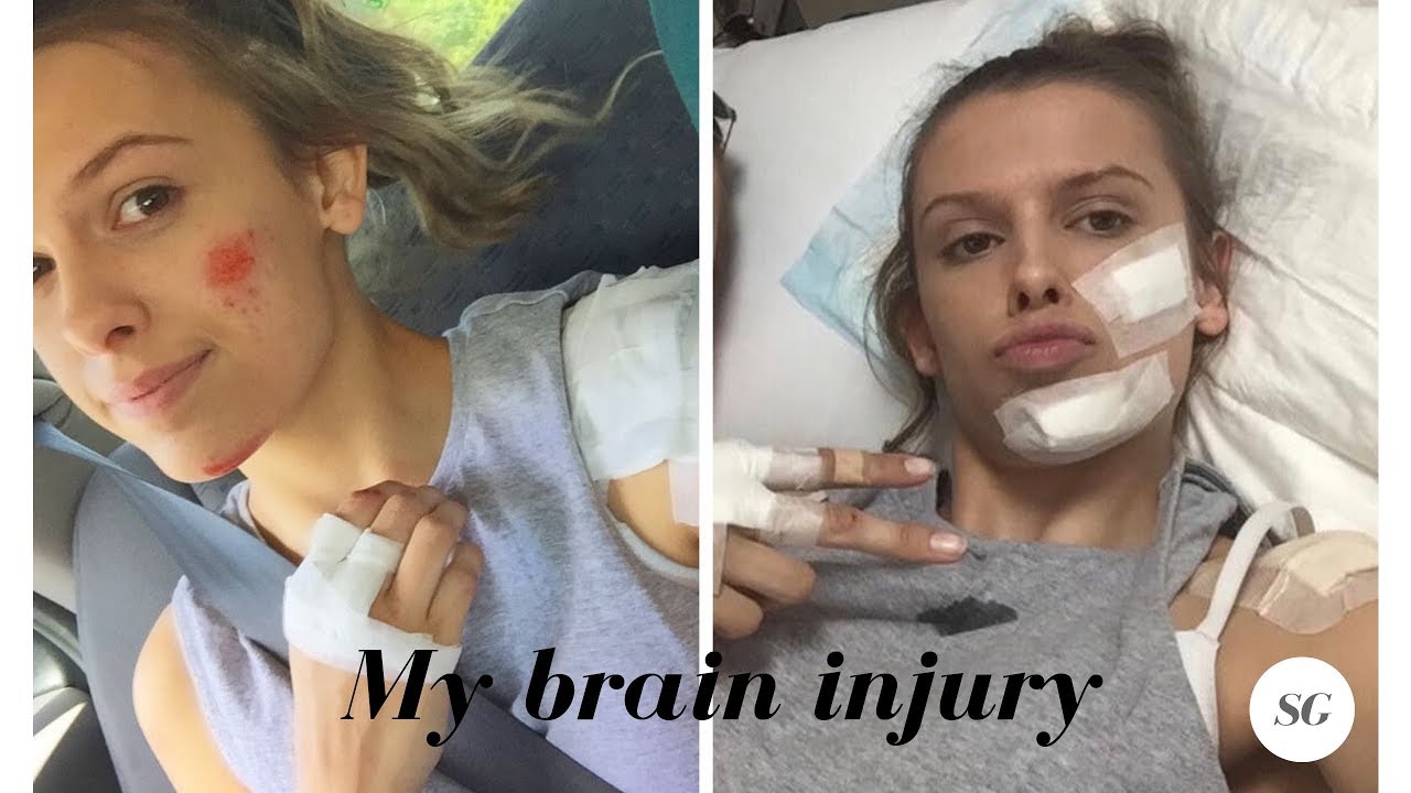 Story time | My brain injury