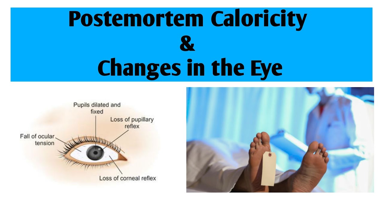 Postmortem caloricity & Changes in the eyes | Forensic medicine | medicolegal Postmortem changes