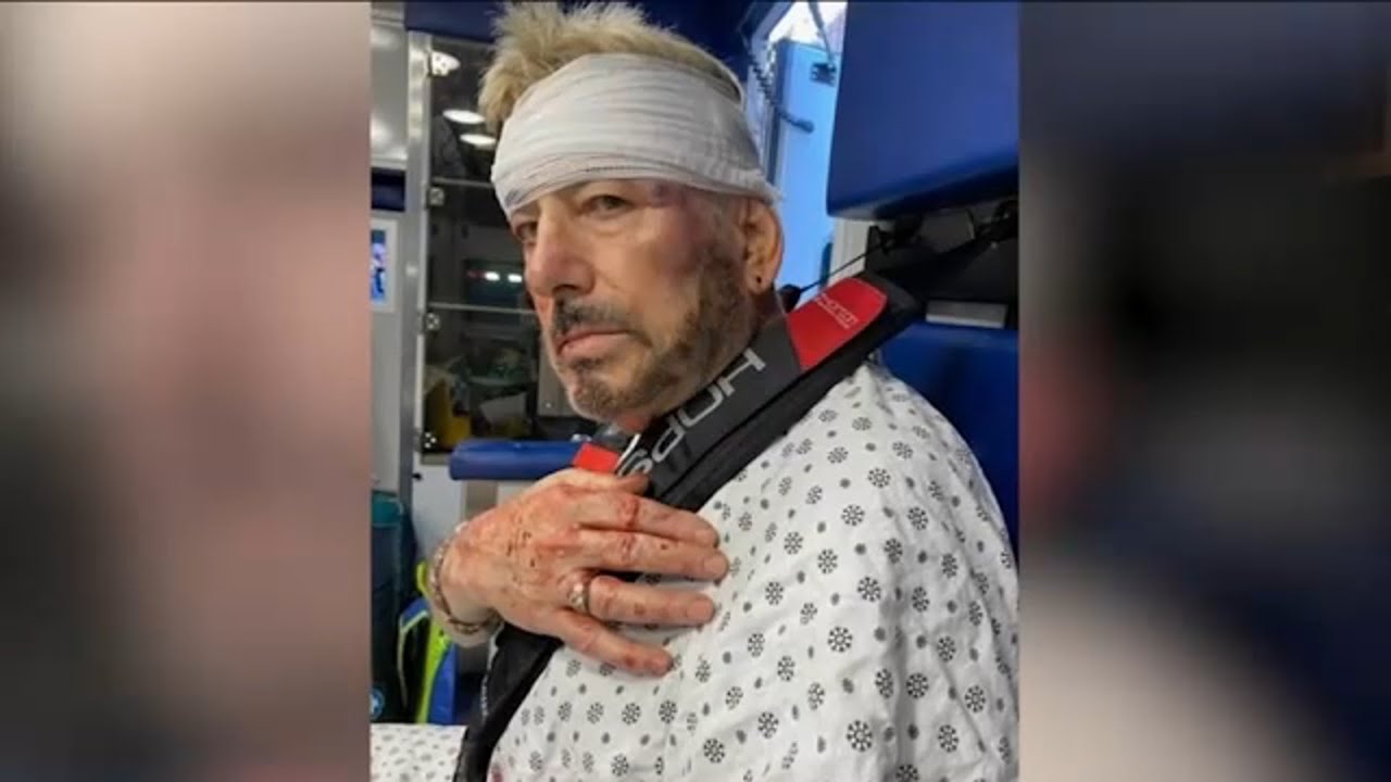 Subway attack victim says MTA, NYPD enforcement efforts came too late