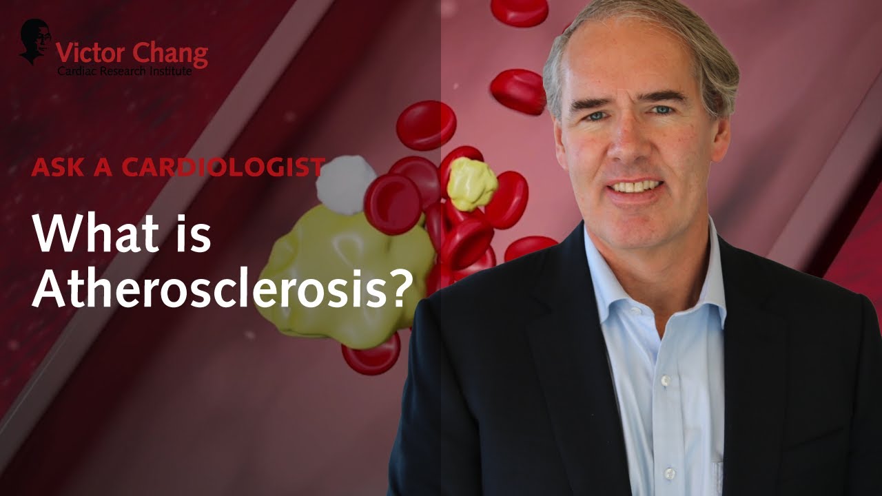 What is Atherosclerosis? Cardiologist Prof Kovacic explains