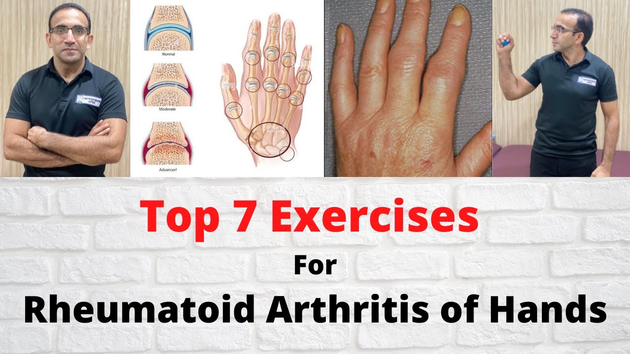 Top 7 Best Exercises for Rheumatoid Arthritis of Hands | Treat Morning Stiffness of RA | Urdu/Hindi