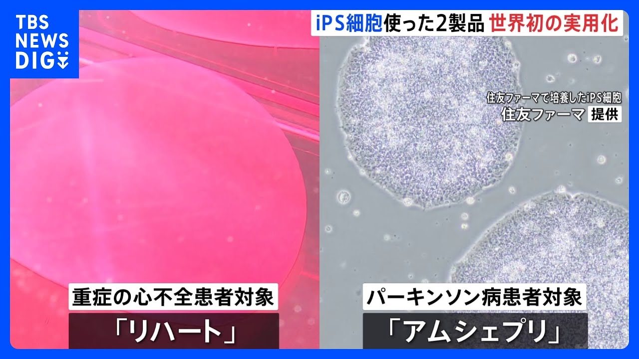 iPS細胞の2製品が世界初の実用化　重症の心不全の患者対象「リハート」・パーキンソン病患者を対象「アムシェプリ」&nbsp;早ければ夏ごろに実用化｜TBS&nbsp;NEWS&nbsp;DIG