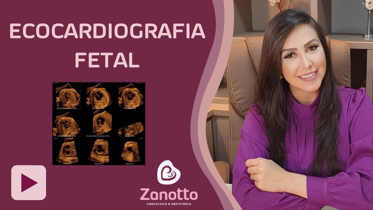 ECOCARDIOGRAFIA FETAL