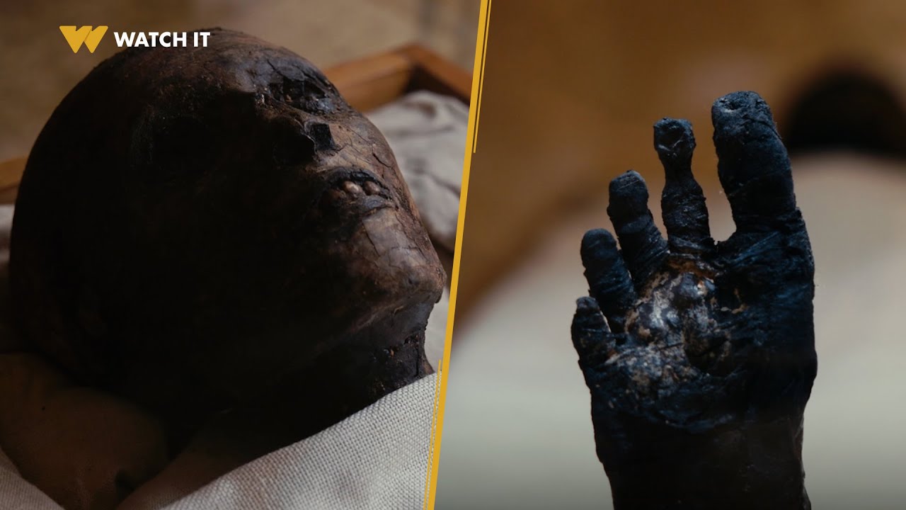 أم الدنيا | مومياء الملك توت عنخ آمون اتفحمت ووصلت لحالة سيئة للسبب ده!