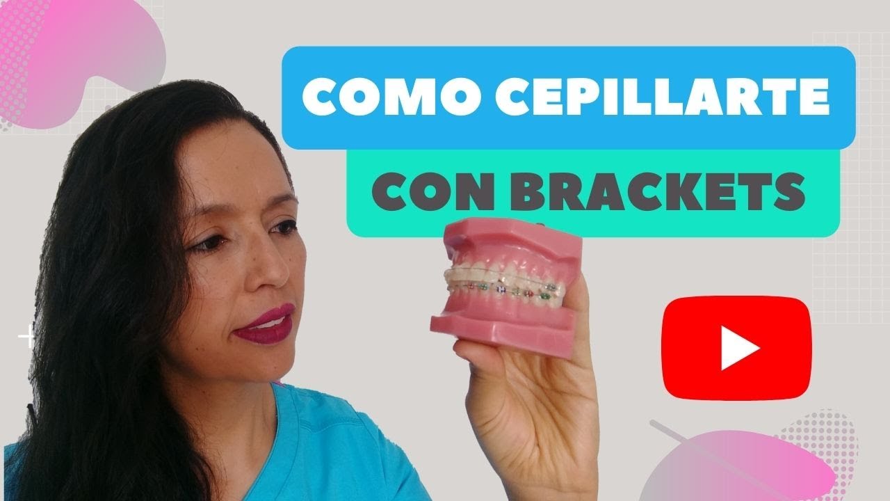 ¿Cómo cepillarte los dientes con brackets?.  GUÍA 2021