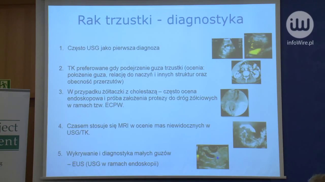 Badaj się. Medycyna wobec raka trzustki jest bezradna