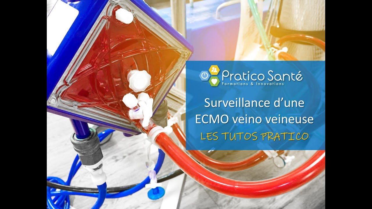 Surveillance d'une ECMO Veino Veineuse Webinar
