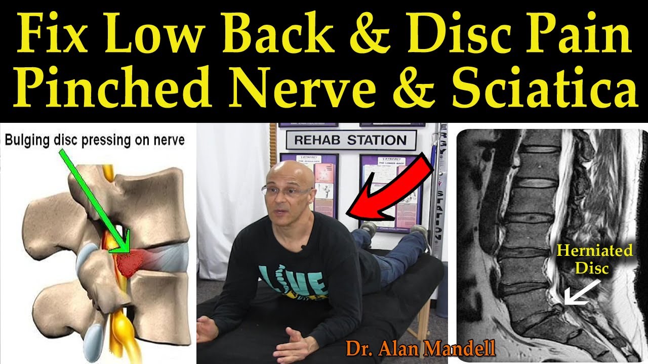 Fix Low Back & Disc Pain, Pinched Nerve & Sciatica - Dr Alan Mandell, D.C.