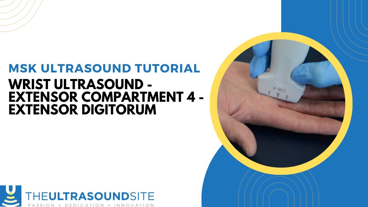 Dorsal wrist ultrasound - Extensor compartment 4 - Extensor Digitorum. #msk