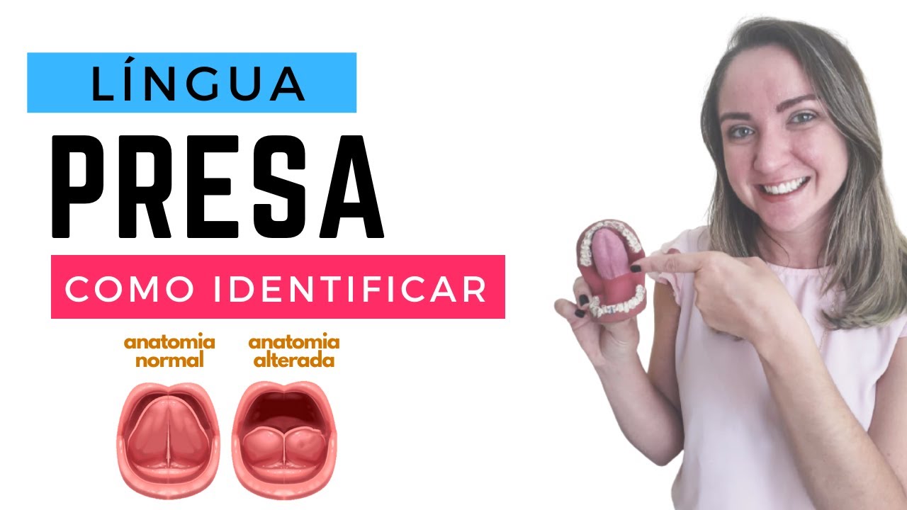 COMO SABER SE A PESSOA TEM LÍNGUA PRESA?