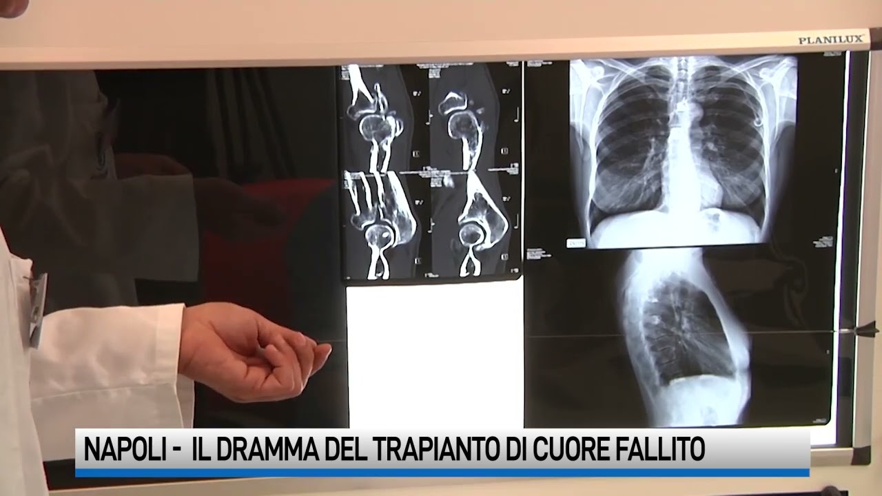 Fallito trapianto di cuore su un bimbo, il dramma e le indagini
