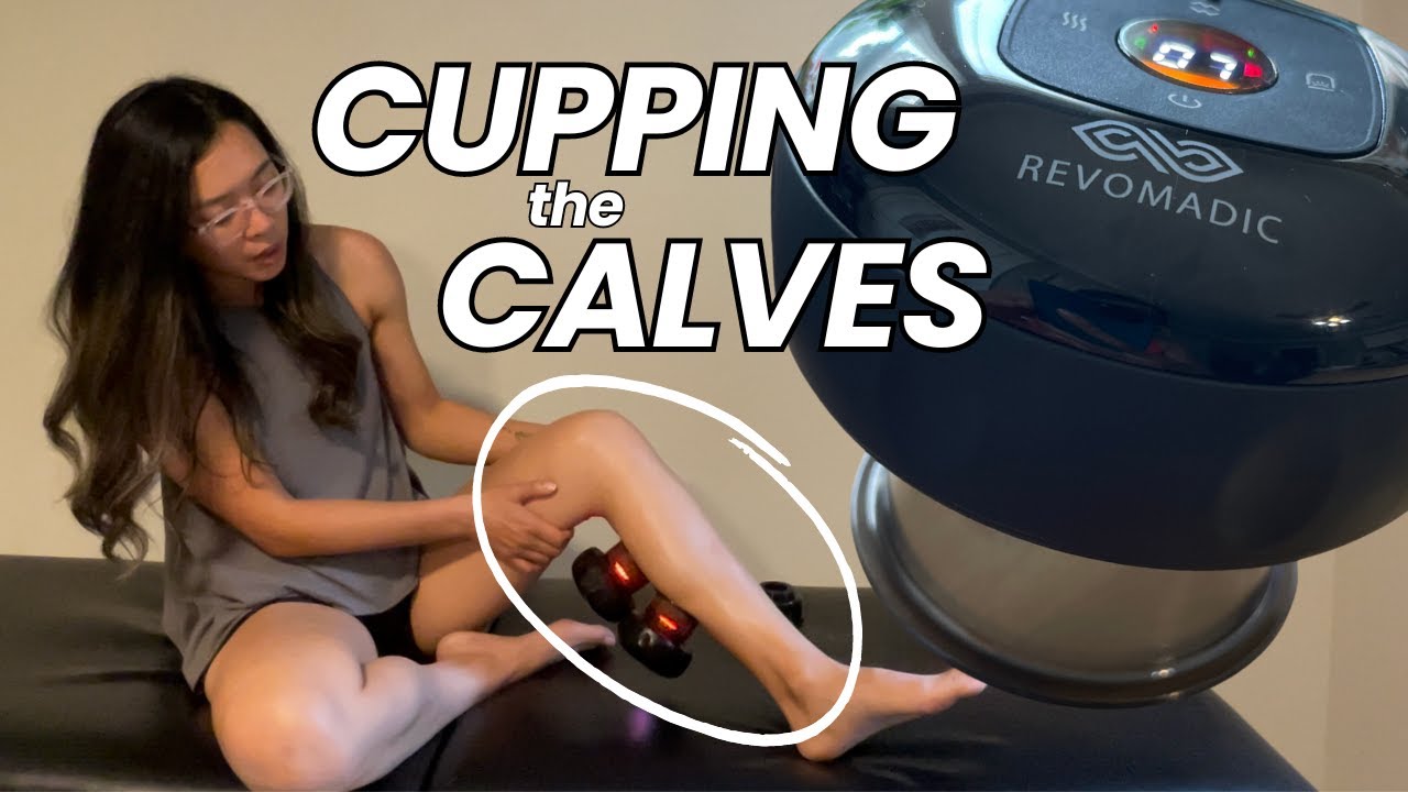 Calf Pain GONE with REVO Smart Cupper│Self-Cupping at Home