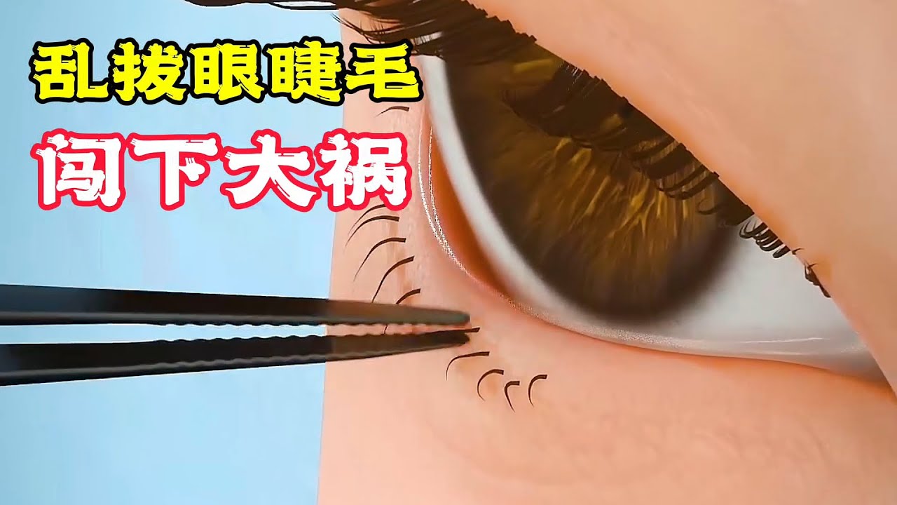 千萬別亂拔眼睫毛，會帶來嚴重危害，你記得了嗎？科普動畫《拔眼睫毛》。科普，電影，短片，成精，解說，搞笑，動畫，喜劇，獵奇，奇幻，腦洞，科幻，超能力，short film
