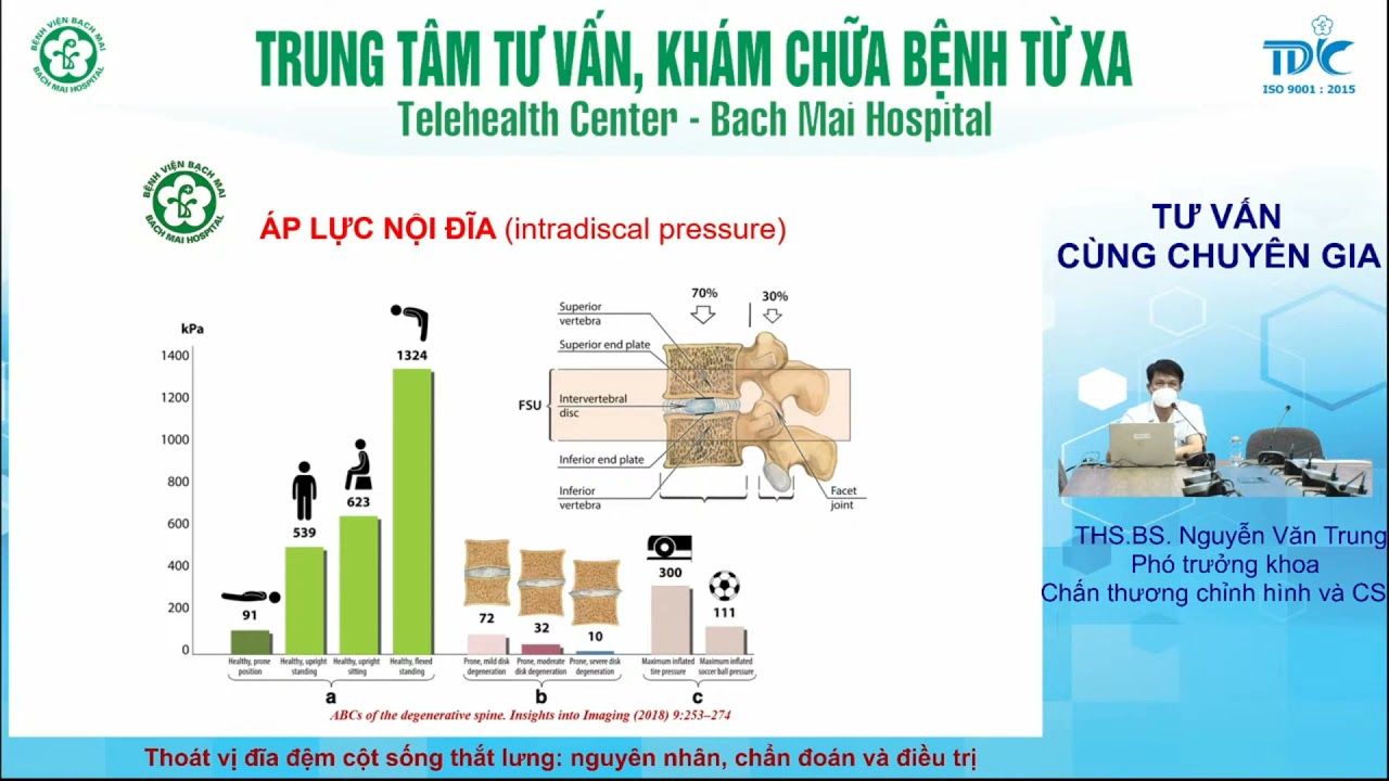 Thoát vị đĩa đệm cột sống thắt lưng - nguyễn nhân, chẩn đoán và điều trị
