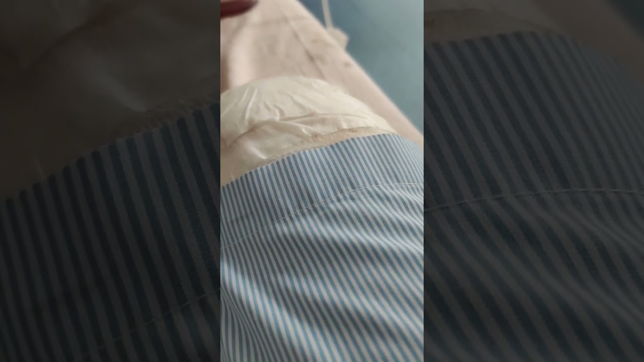 My Diabetic foot has been amputated last eventing by By Dr Deshmukh at Benz Hospital Santacruz