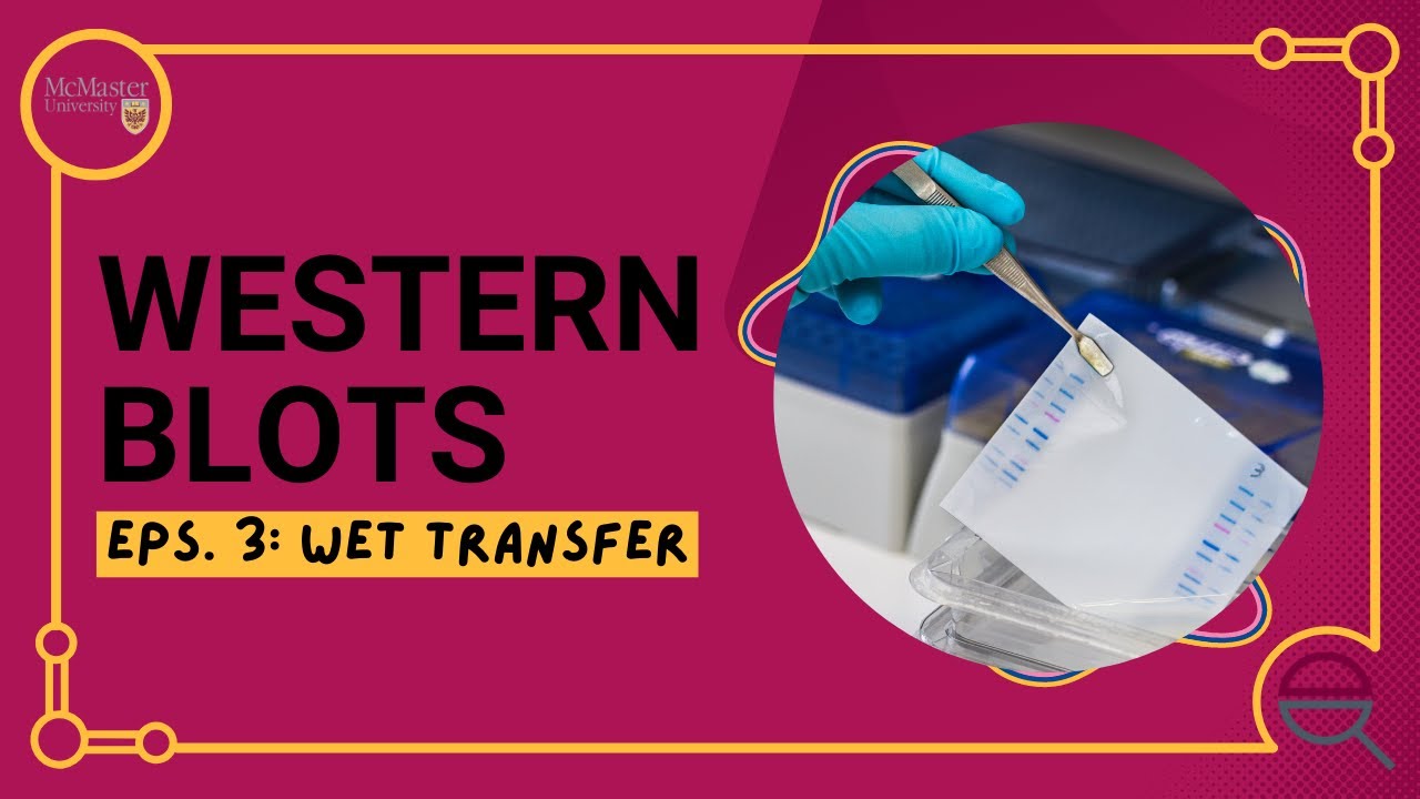 Western Blot: How to do a Wet Transfer
