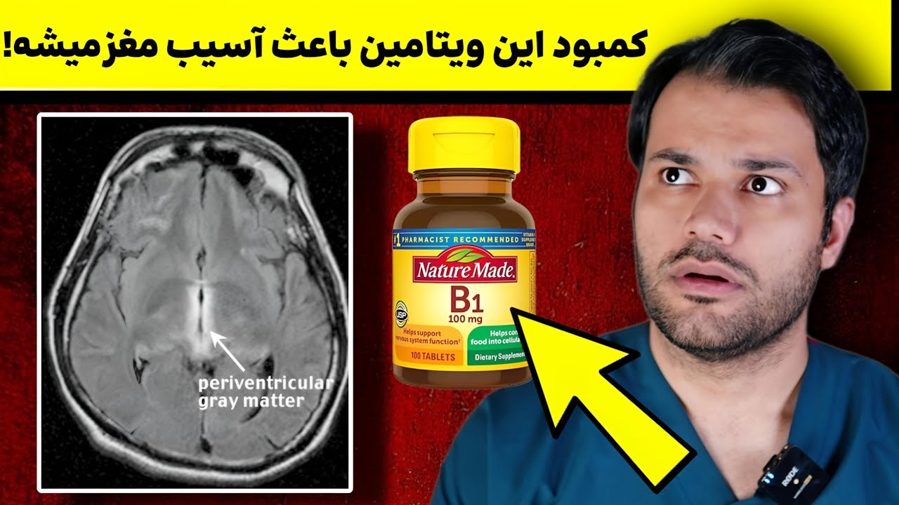 10 علامت کمبود ویتامین B1 که باید بدونید ❌️ کمبودش باعث آسیب به مغز میشه!