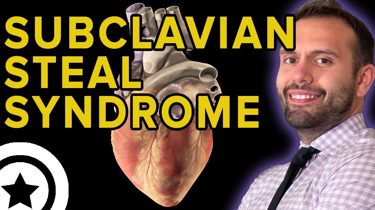 Subclavian Steal Syndrome | HIGH-YIELD CARDIOLOGY | USMLE STEP 1